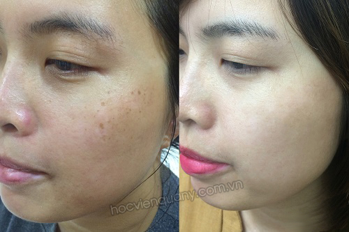 Trước và sau khi sử dụng kem dưỡng da SK Ginseng